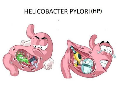 Vi khuẩn HP có mặt trong 80% các ca viêm dạ dày