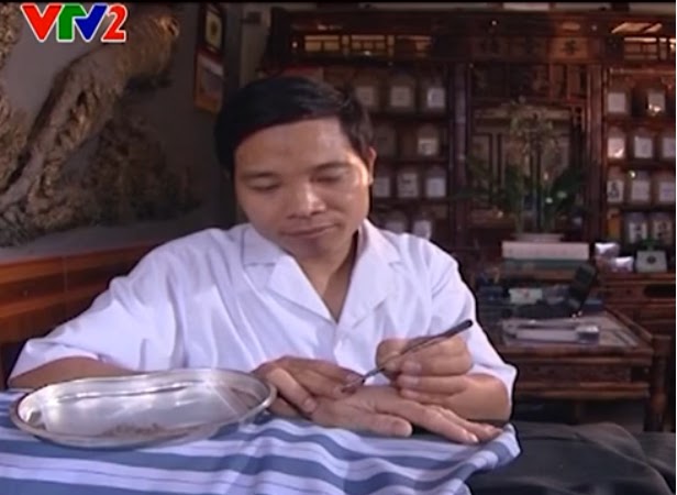 lương y Phạm Ngọc châm cứu cho bệnh nhân