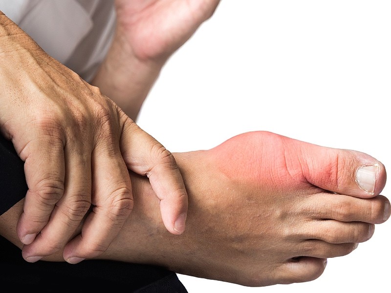 thống phong chữa theo Đông Y