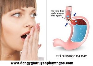 Trào-ngược