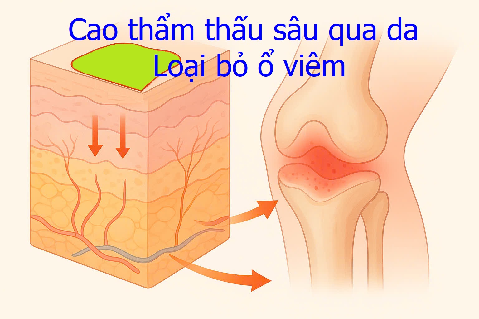 cao dán xương khớp phạm ngọc