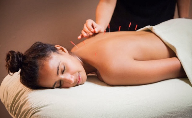 Y học cổ truyền Việt Nam chữa đau lưng và thoát vị đĩa đệm bằng châm cứu và thảo dược.