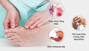 Đông y điều trị gút